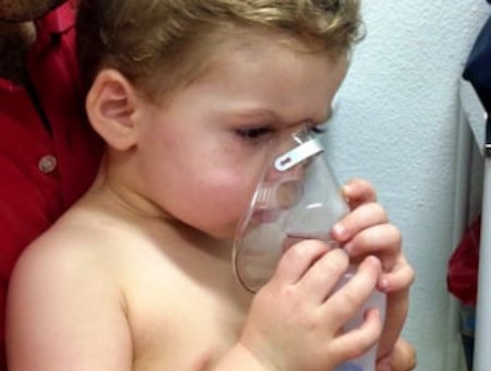 Niño con bronquiolitis durante su tratamiento